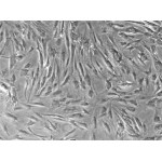 Human Preadipocytes / Adipocytes (hPAds)